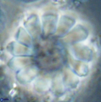 Discoaster tortinodosus 61053