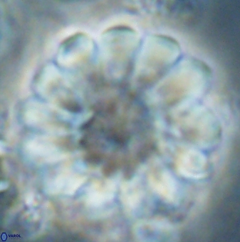 Discoaster tortinodosus 61054