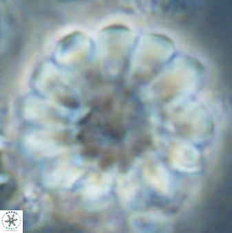 Discoaster tortinodosus 61054