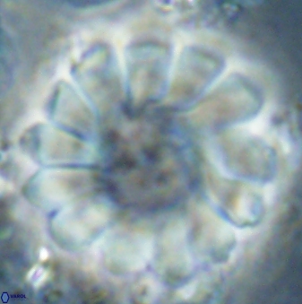 Discoaster tortinodosus 61055