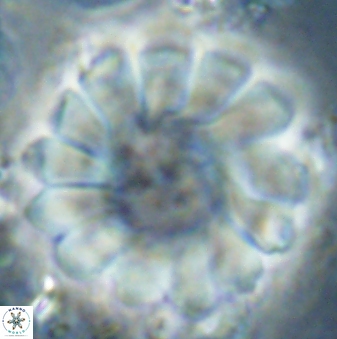 Discoaster tortinodosus 61055