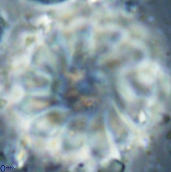 Discoaster tortinodosus 61056