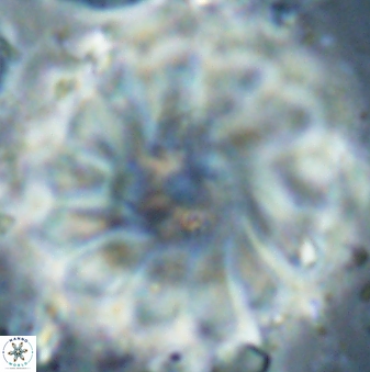 Discoaster tortinodosus 61056