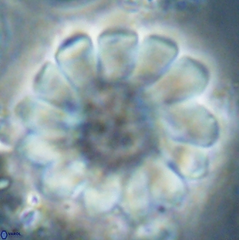 Discoaster tortinodosus 61057