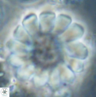 Discoaster tortinodosus 61057