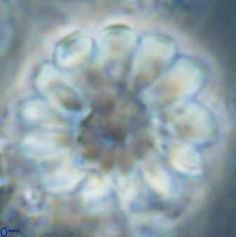 Discoaster tortinodosus 61058