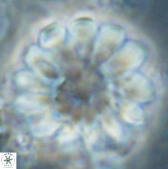 Discoaster tortinodosus 61058