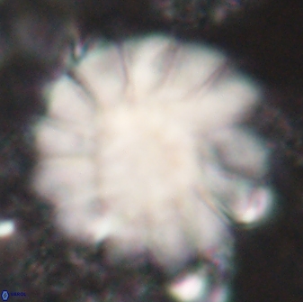 Discoaster tortinodosus 61059