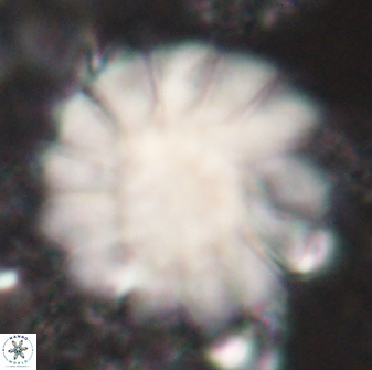 Discoaster tortinodosus 61059