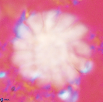 Discoaster tortinodosus 61063