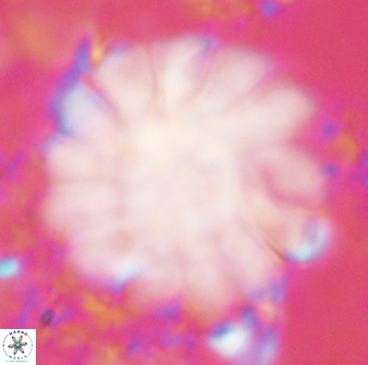 Discoaster tortinodosus 61063