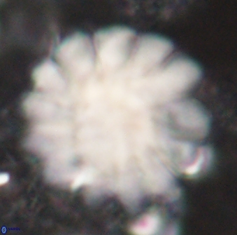 Discoaster tortinodosus 61064