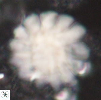 Discoaster tortinodosus 61064