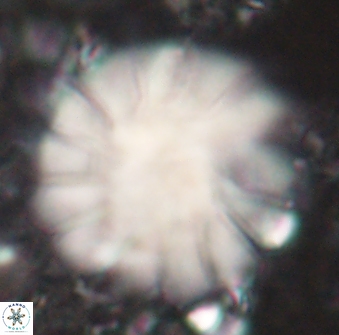 Discoaster tortinodosus 61065