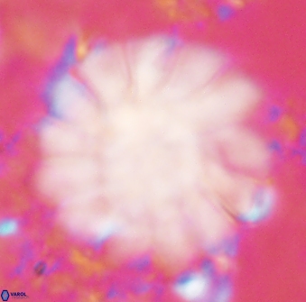 Discoaster tortinodosus 61066