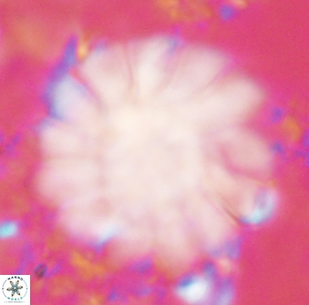 Discoaster tortinodosus 61066