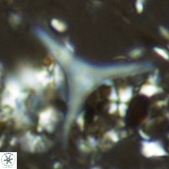 Discoaster triradiatus VR 06215