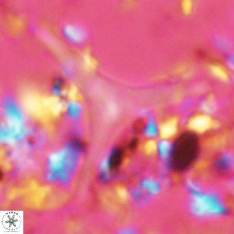 Discoaster triradiatus VR 06216