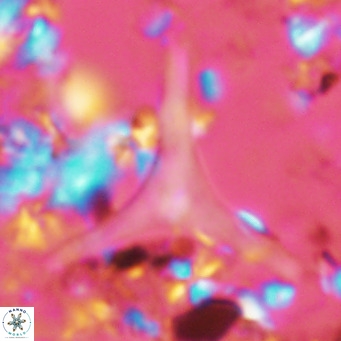 Discoaster triradiatus VR 06217