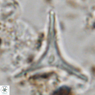 Discoaster triradiatus VR 06219