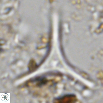 Discoaster triradiatus VR 06220