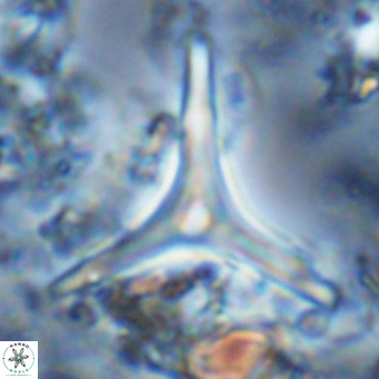 Discoaster triradiatus VR 06222