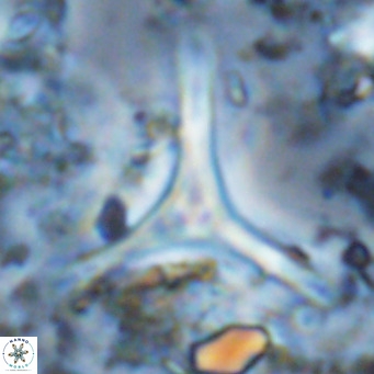 Discoaster triradiatus VR 06223