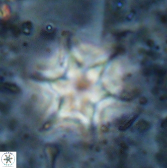 Discoaster vandekampiorum 27334