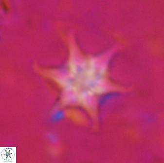 Discoaster vandekampiorum 27337