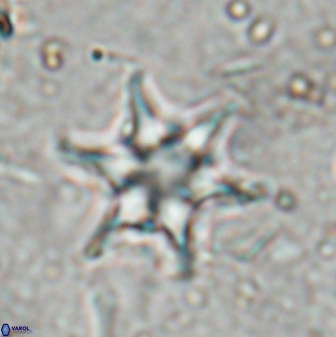 Discoaster vandekampiorum 27330