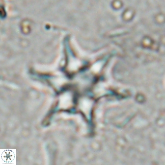 Discoaster vandekampiorum 27330