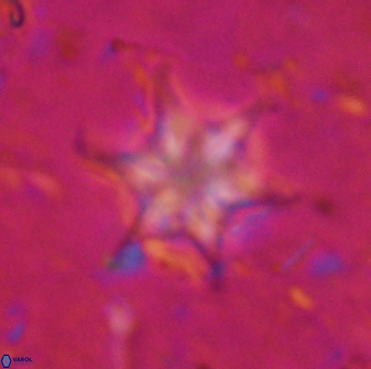 Discoaster vandekampiorum 27340