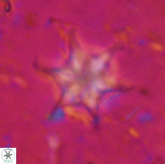 Discoaster vandekampiorum 27340