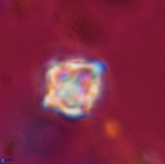 Discoaster vandekampiorum 28477