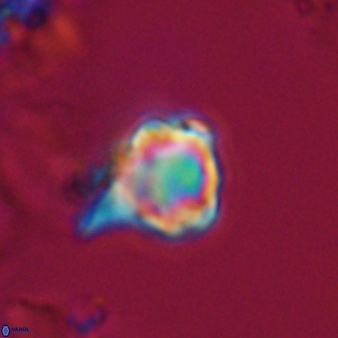 Discoaster vandekampiorum 28486