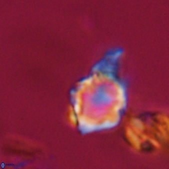 Discoaster vandekampiorum 28487