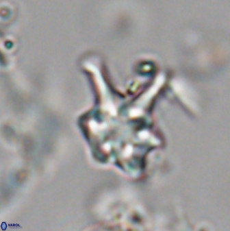 Discoaster vandekampiorum 28489