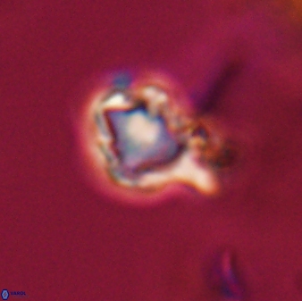 Discoaster vandekampiorum 28481