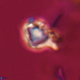 Discoaster vandekampiorum 27329