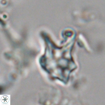 Discoaster vandekampiorum 28493