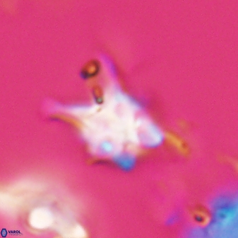 Discoaster vandekampiorum 28504