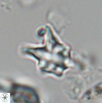 Discoaster vandekampiorum 28506