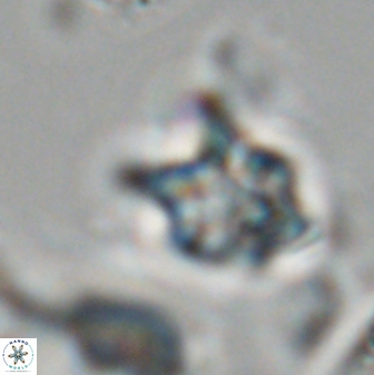Discoaster vandekampiorum 28507