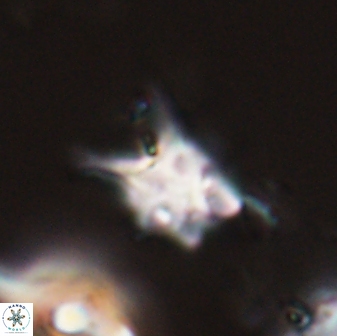Discoaster vandekampiorum 28503