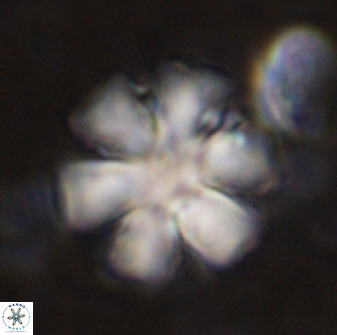Discoaster woodringi 49256