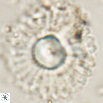 Discoaster bordii 58025