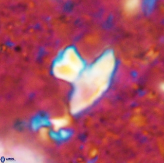 Discoasteroides kuepperi 48981