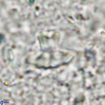 Discoasteroides kuepperi 48987