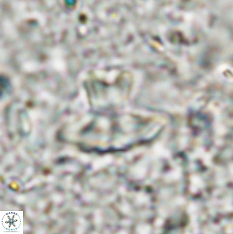 Discoasteroides kuepperi 48987