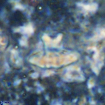 Discoasteroides kuepperi 48988